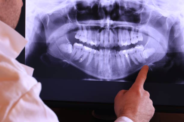 Best Weekend Emergency Dentist in Copperopolis, CA