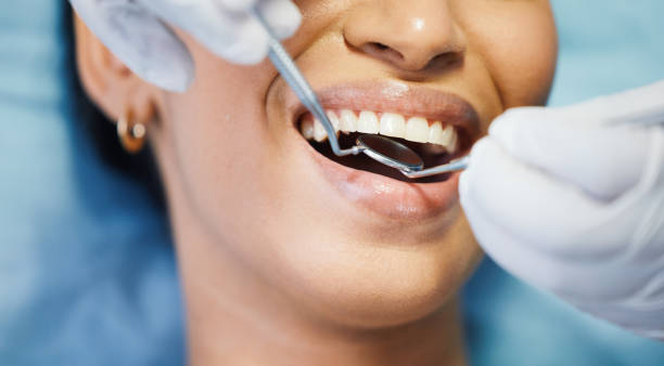 Best Emergency Dental Care for Abscessed Tooth in Copperopolis, CA